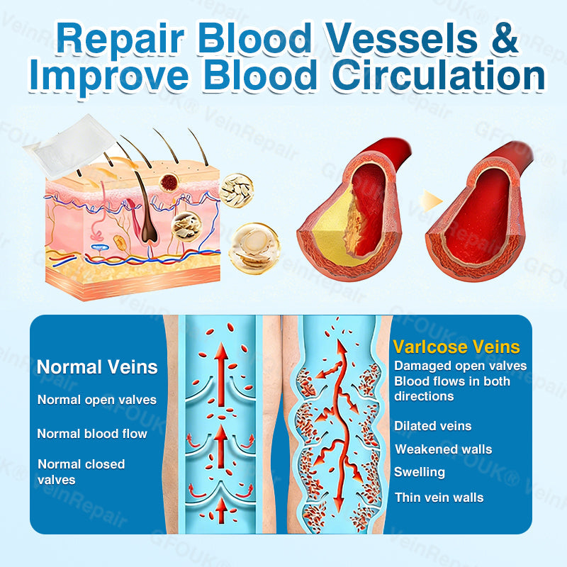 💛💛GFOUK® VeinRepair Microneedle Patch Roll⚡Instant Relief, Long-Term Results