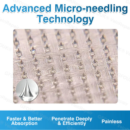 💛💛GFOUK® VeinRepair Microneedle Patch Roll⚡Instant Relief, Long-Term Results