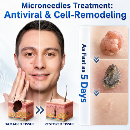 👩‍⚕️👑 𝐎𝐟𝐟𝐢𝐜𝐢𝐚𝐥 𝐒𝐭𝐨𝐫𝐞 | 𝑵𝐞𝒌𝐢𝐬𝐬® 🌿 𝐁𝐨𝐭𝐚𝐧𝐢𝐜𝐚𝐥 𝐌𝐢𝐜𝐫𝐨𝐧𝐞𝐞𝐝𝐥𝐞 𝐇𝐲𝐝𝐫𝐨𝐜𝐨𝐥𝐥𝐨𝐢𝐝 𝐏𝐚𝐭𝐜𝐡 (𝐅𝐨𝐫 𝐒𝐤𝐢𝐧 𝐓𝐚𝐠𝐬, 𝐒𝐦𝐚𝐥𝐥 𝐒𝐤𝐢𝐧 𝐆𝐫𝐨𝐰𝐭𝐡𝐬, 𝐖𝐚𝐫𝐭𝐬, 𝐌𝐨𝐥𝐞𝐬, 𝐀𝐠𝐞 𝐒𝐩𝐨𝐭𝐬 & 𝐏𝐢𝐠𝐦𝐞𝐧𝐭𝐚𝐭𝐢𝐨𝐧 𝐂𝐨𝐧𝐜𝐞𝐫𝐧𝐬)